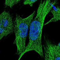 RPUSD2 Antibody, Novus Biologicals:Antibodies:Primary Antibodies